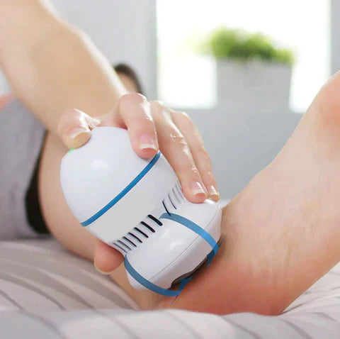 Radiant You Vacuum Callus Remover
